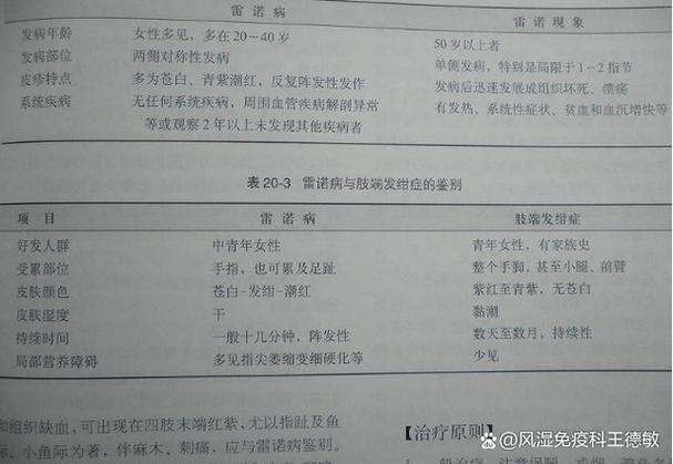 雷诺综合征挂什么科，雷诺综合征挂什么科室  第7张