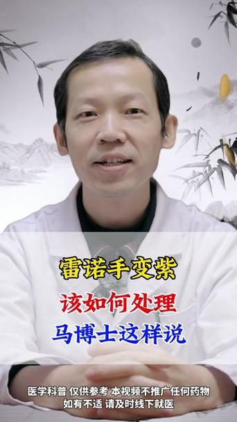 雷诺综合症能治好吗，雷诺综合症能治好吗女性  第7张